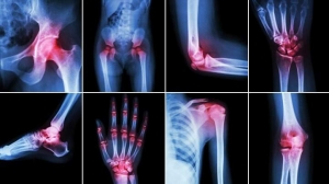 Everything You Should Know About Joint Supplements Everything You Should Know About Joint Supplements